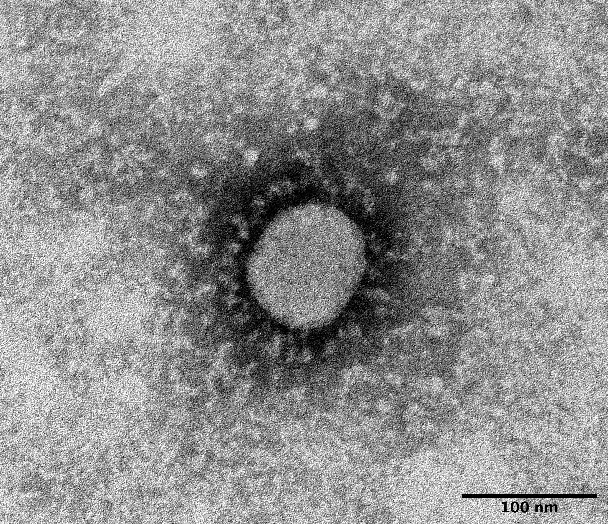 新型コロナウイルスの変異型を国内で初確認